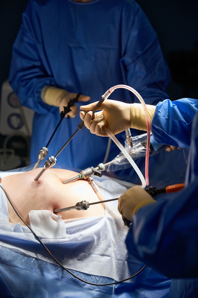 Laparoscopic,Instruments.,Hands,In,Protective,Gloves.,Modern,Abdominal,Surgery Laparoscopic,Instruments.,Hands,In,Protective,Gloves.,Modern,Abdominal,Surgery